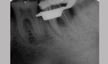 Dental clinic in Anand
                        